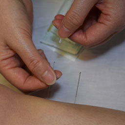 Doctor Cao doing Acupuncture at the East West College of Natural Medicine.
