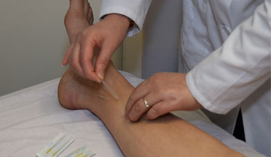 Doctor Cao treating a patient with Acupuncture at the East West College of Natural Medicine.